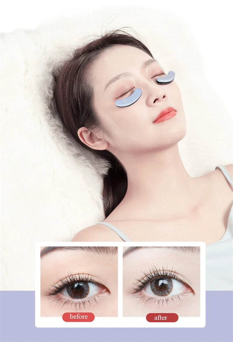 EMS Red Light Eye Massager